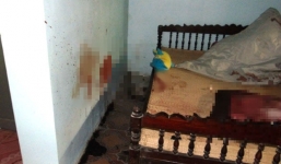 Bé gái 14 tuổi bị đánh đập dã man ở Thanh Hóa vẫn còn yếu nên chưa phẫu thuật